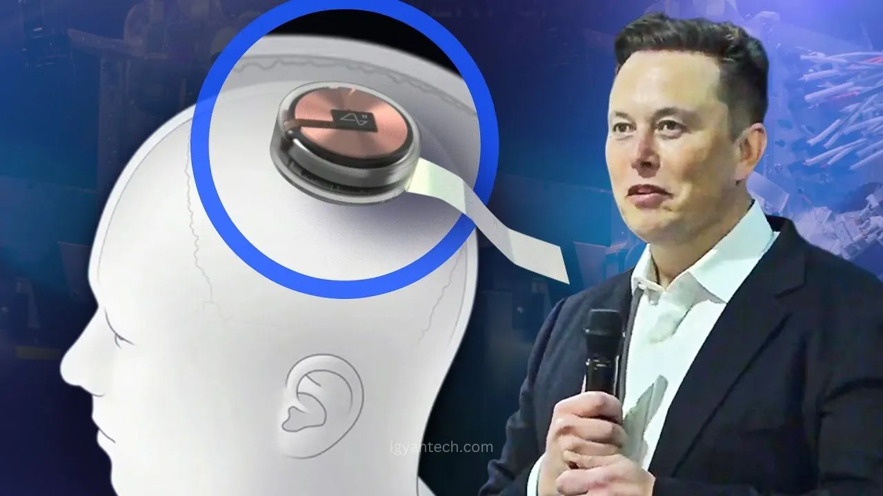 Brain Chip by Elon Musk