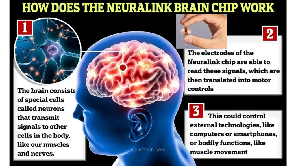 How does Neuralink work